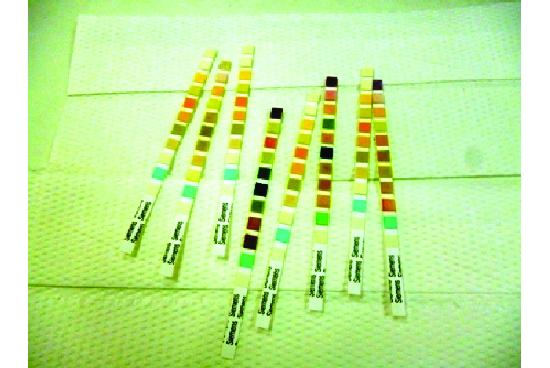 This image shows rectangular test strips which have different coloured bands on them.